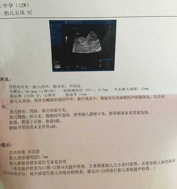 广州在做代孕的费用，广州代妈费用