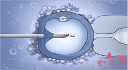 2022年西安唐都医院供卵试管手术申请流程是怎样的？