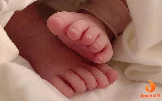 广州供卵公司包男孩,【广州供卵机构包男孩】31周顺产女宝宝