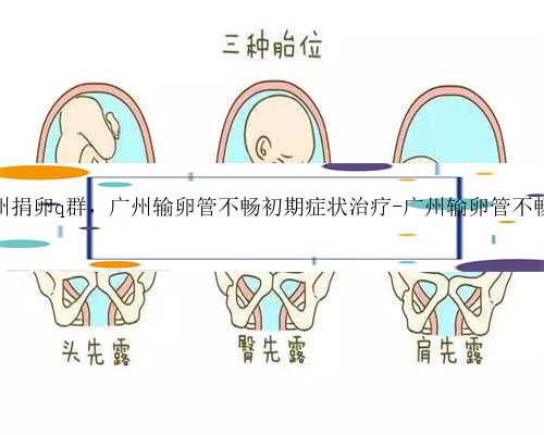 广州捐卵q群，广州输卵管不畅初期症状治疗-广州输卵管不畅哪